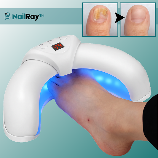 NailRay™ Laser Negle-Enhed