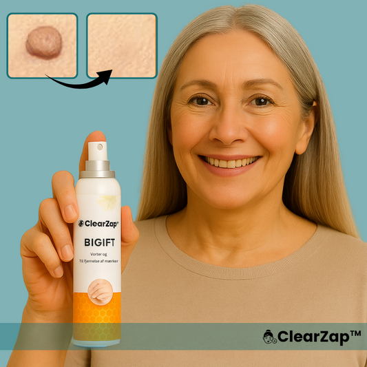 ClearZap™ Vortefjerning