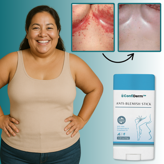 ConfiDerm™ Anti-Blemish Stick