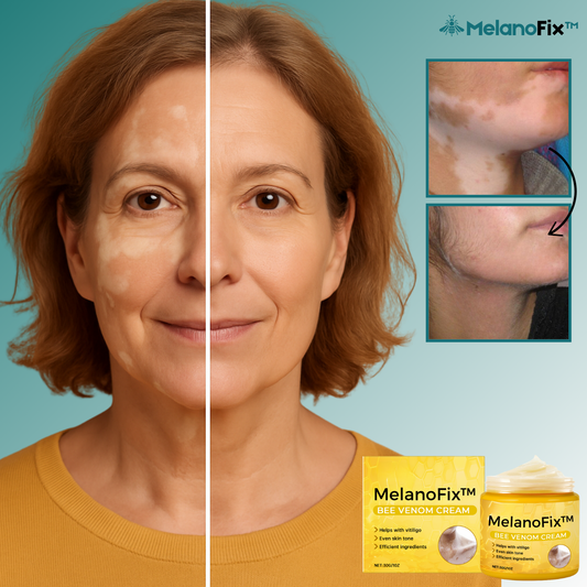 MelanoFix™ Lysnende & Regenererende Creme