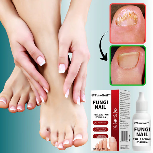 PureNail™ Neglesvampfjerner