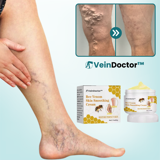 VeinDoctor™ Creme Mod Åreknuder
