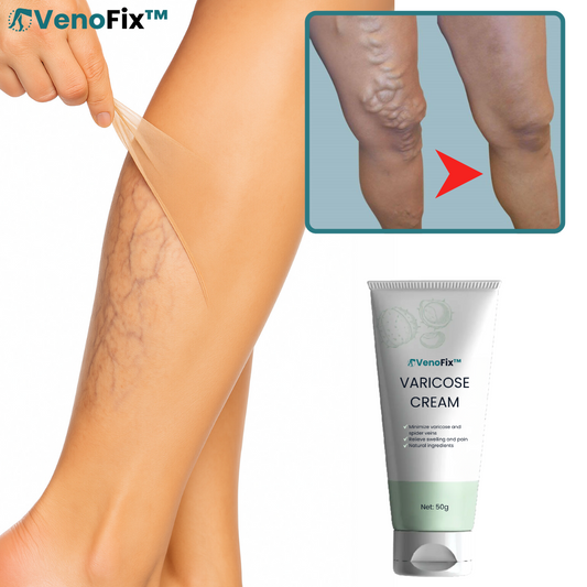 VenoFix™ Åreknudecreme